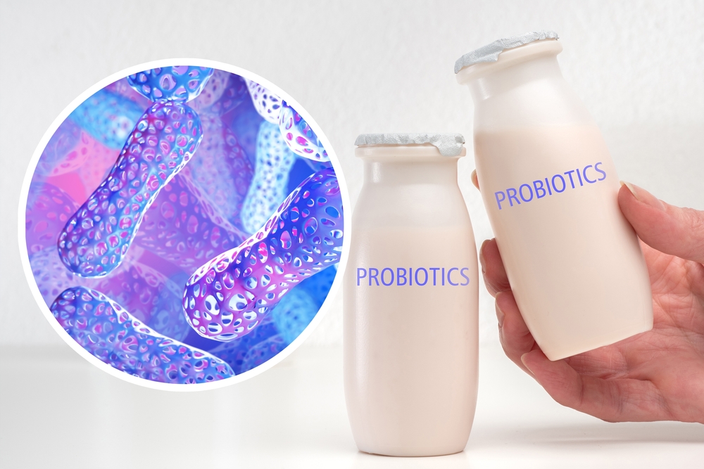 PROBIOTICI E FERMENTI LATTICI: CAPIAMO MEGLIO